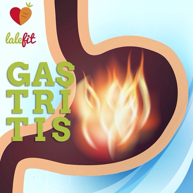 Everything you must know about gastritis